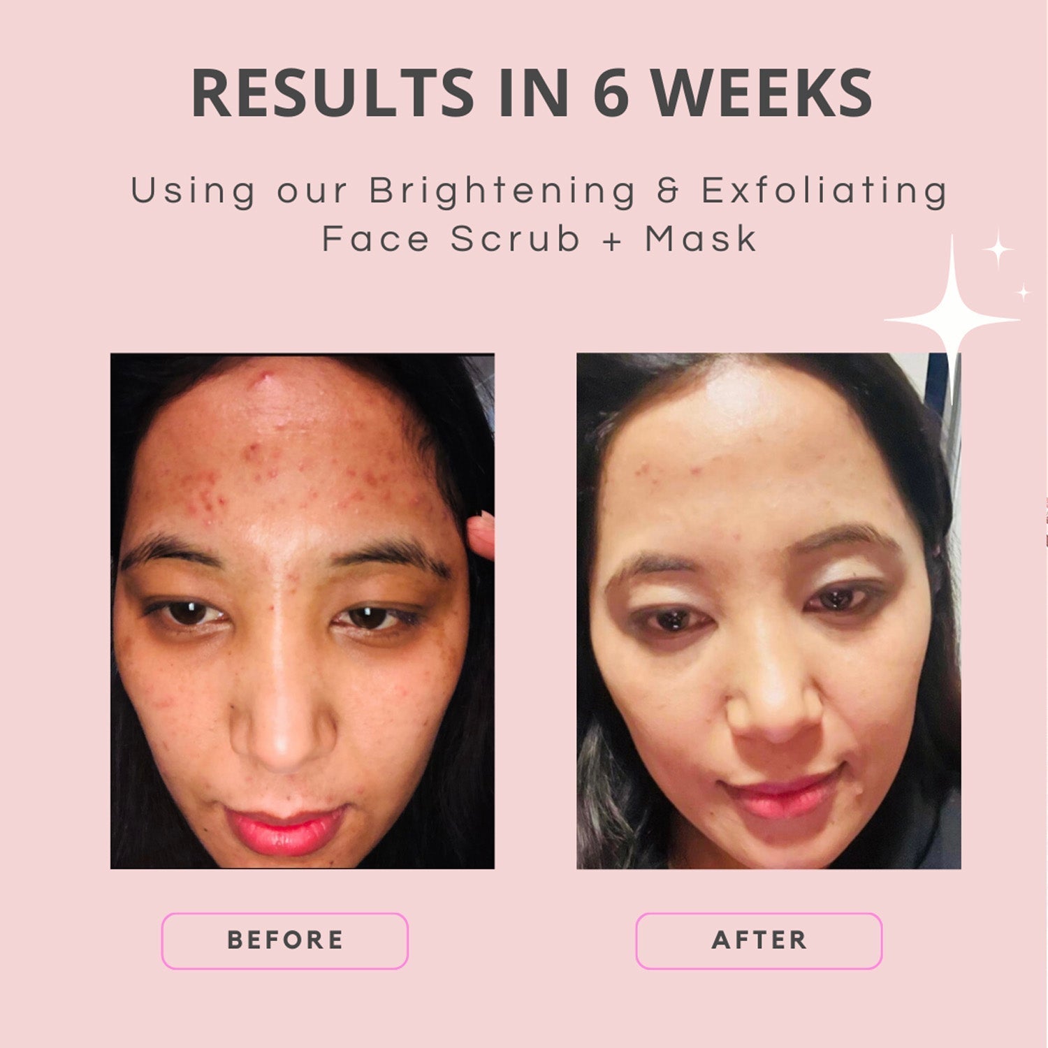 Brightening & Exfoliating Face Scrub + Mask 70gm-Skin Crush-stride